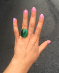 Vermeil Malachite Ring